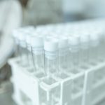 a rack of sample tubes used for genetic ancestry testing