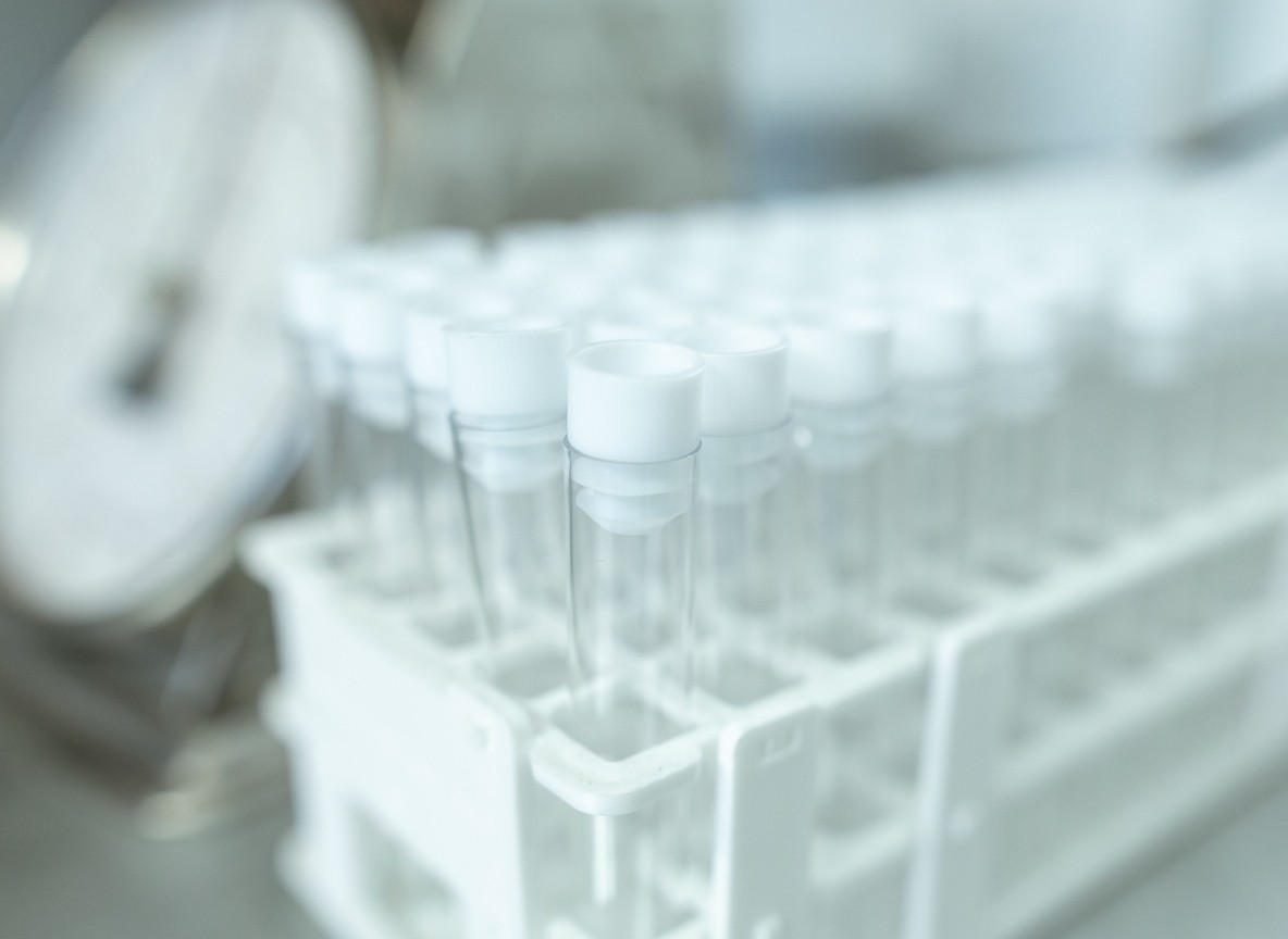 a rack of sample tubes used for genetic ancestry testing